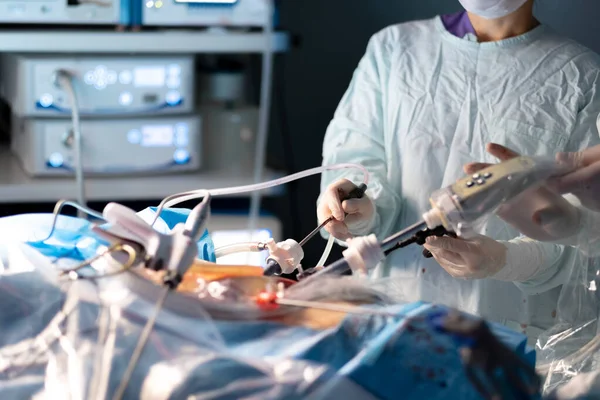 Laparoskopik ameliyat sırasında bir cerrahın elindeki tıbbi alet..