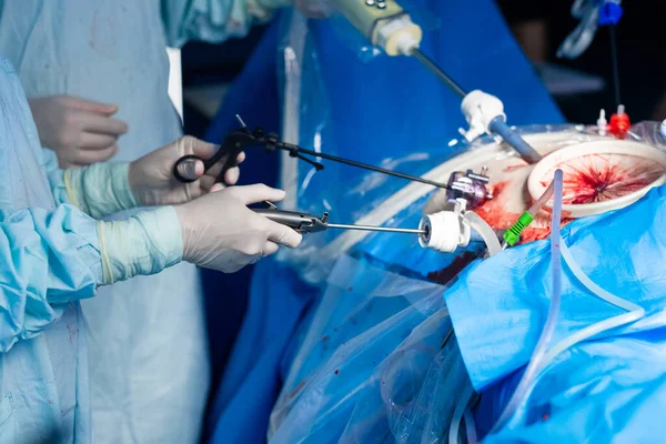 Lékařský laparoskopický nástroj v rukou chirurga — Stock fotografie