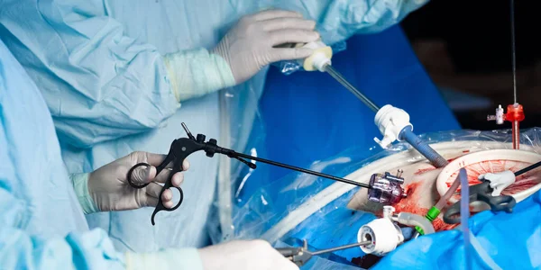 Selectieve focus op laparoscopische instrumenten in handen van chirurgen — Stockfoto