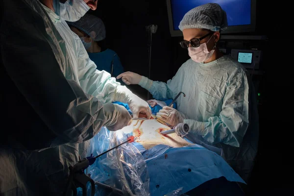 A woman surgeon in 3D glasses performs a laparoscopic surgery