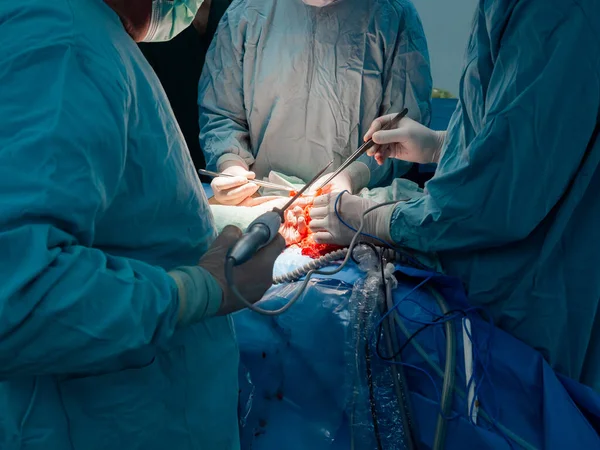 Un grupo de cirujanos opera a un paciente con cáncer. — Foto de Stock