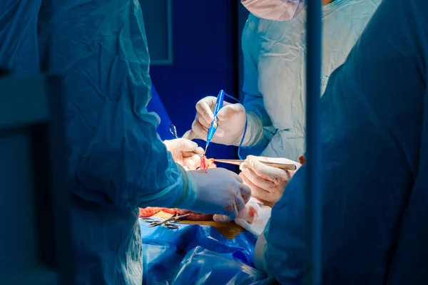 Las manos de los cirujanos con guantes estériles operan con un electrocoagulador. — Foto de Stock