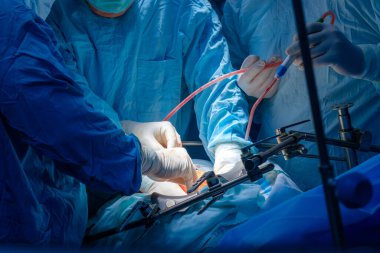 Hands of doctors in sterile gloves