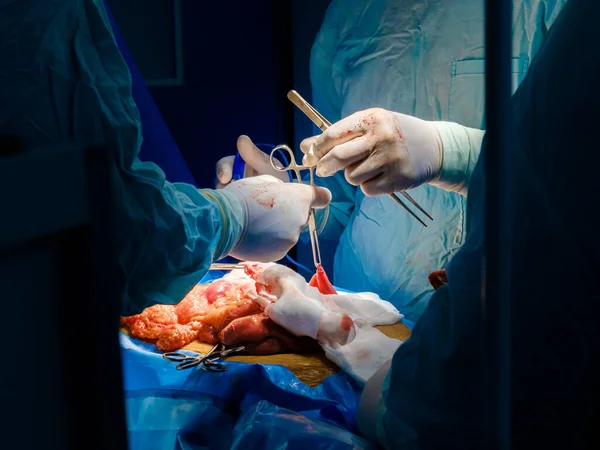 Doctors hands use surgical instruments during surgery. — Foto de Stock