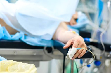 Ameliyat sırasında insan parmağında nabız oksimetresi..