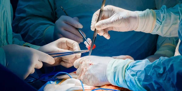Tým profesionálních chirurgů operuje s pacientem — Stock fotografie