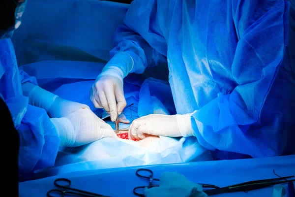 Las manos de los cirujanos con guantes estériles blancos cosen la piel de los pacientes —  Fotos de Stock
