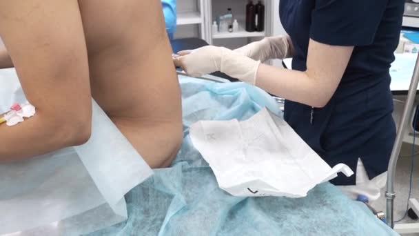 Suntikan anestesi epidural dalam persiapan untuk operasi. — Stok Video