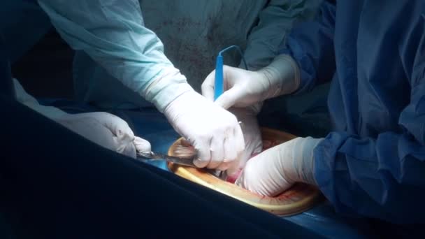 Le mani dei chirurghi operano il paziente con un coagulatore elettrico. — Video Stock