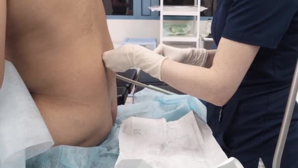 Anesthetist menyuntikkan injeksi epidural ke pasien kembali. — Stok Video