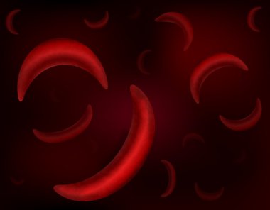 Sickle-cell anemia red blood cells clipart