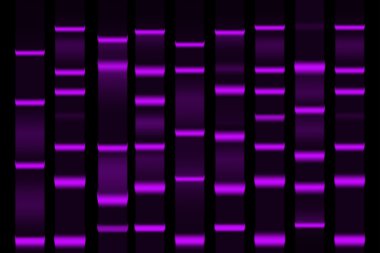 Jel Elektroforez ayrılık electrophoretogram