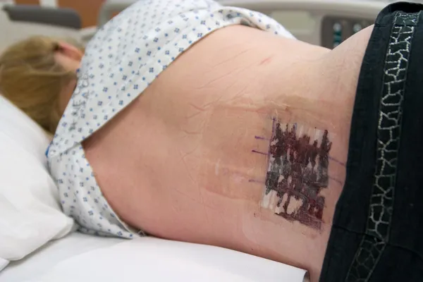 hasta hastane yatağında onun tarafında