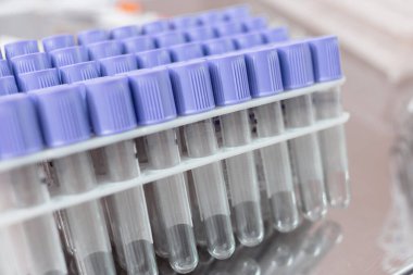 Laboratuvarda analiz tüpü veya manipülasyon odasında test tüpü.