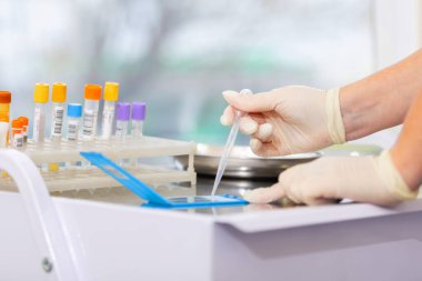 Laboratuvarda, bilim adamının el ele deney tüpü. Üniformalı doktor laboratuarda test tüpü üzerinde çalışıyor..