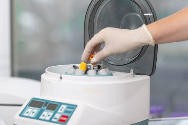 Tıbbi santrifüj. Bilim adamı tıbbi veya bilimsel laboratuardaki santrifüj makinesine örnek yüklüyor.