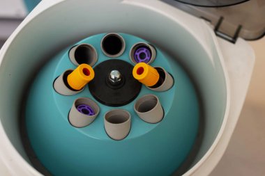 Tıbbi ve bilimsel araştırmalar için laboratuardaki sıvıları ayırmak için kullanılan dönen birimlerin içindeki numunelerle açılan laboratuvar santrifüjünü kapat.