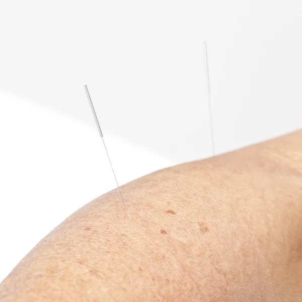 Man Arm Laser Beam Scar Removal Technology Skin Treatment Concept Stock