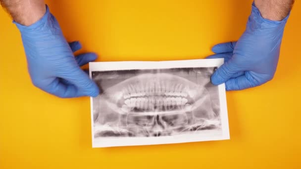 青いゴム手袋の男性歯科矯正医の手は歯の写真を保持し 明るい黄色の背景にそれを検討しています — ストック動画