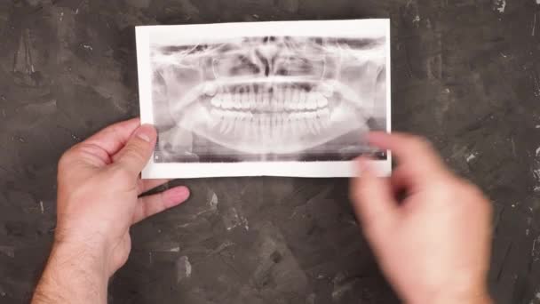 男性正牙医生手握牙齿照片 在黑色背景下检查牙齿 — 图库视频影像