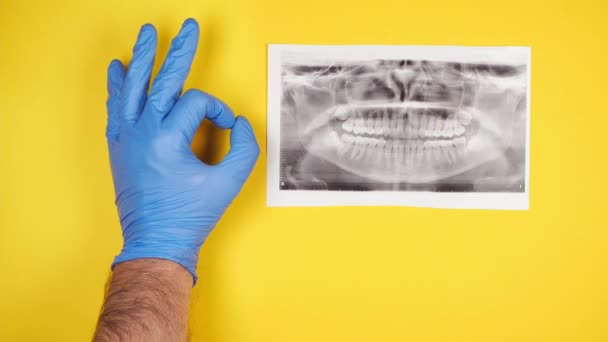 一位戴橡胶蓝色防护手套的正牙医生的手在黄色背景的X光牙齿旁边显示出了好的标志 — 图库视频影像
