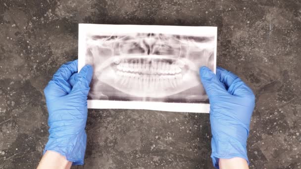 青いゴム手袋の女性歯科矯正医の手は 歯や歯科X線の写真を保持し 灰色の背景にそれを検討しています — ストック動画
