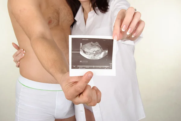 Imagen de ultrasonido fetal — Foto de Stock