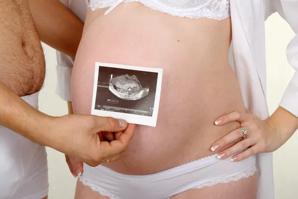 胎児の超音波画像 — ストック写真