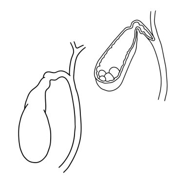 İnsan safra kesesi ve enine kesiti. Vektör, taslak, anatomik, beyaz arkaplan üzerine el çizimi illüstrasyon.