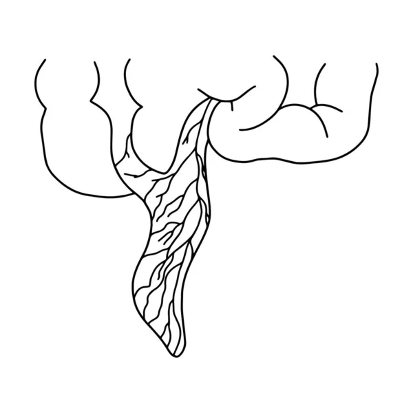阑尾炎一种由白色背景上的线条画出的人类阑尾炎矢量存量说明 — 图库矢量图片