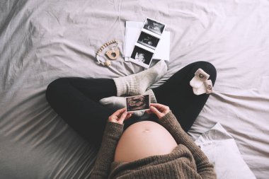 Ultrason görüntüsü taşıyan hamile bir kadın soğuk kış günlerinde sıcak örülü kazak giymiş tıbbi test sonuçlarına bakıyor. Hamile karnı olan hamile bir anne bebek bekliyor. Hamilelik kavramı.