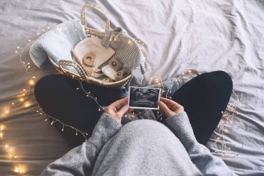 Hamile bir kadının ultrason görüntüsünü elinde sepet ve yeni doğmuş şeylerle taşıdığı görüntüsü. Müstakbel anne hamilelik süresince bebek doğumu bekliyor. Hamile kalmak, bebek partisi, soğuk gün havası.