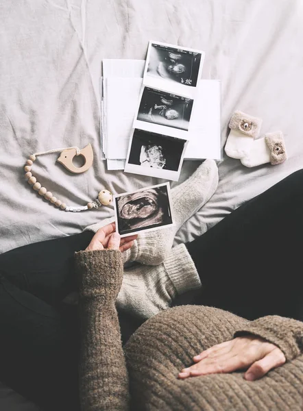 Donna Incinta Che Tiene Immagine Ecografica Guardando Rapporti Test Medici — Foto Stock