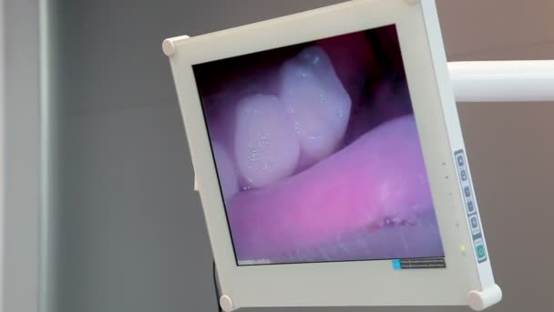 Visita na clínica odontológica, mulher dentista mostrando os dentes do paciente no monitor — Vídeo de Stock