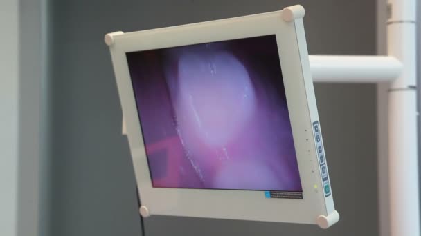 Επίσκεψη στην οδοντιατρική κλινική, οδοντίατρος γυναίκα δείχνει τα δόντια του ασθενούς στην οθόνη — Αρχείο Βίντεο