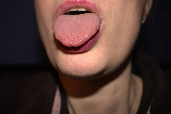 波打つリップルホタテの縁 医療名はマクログロシア と横の隆起を持つ腫れた白い舌 — ストック写真
