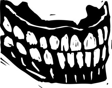 takma diş gravür çizimi