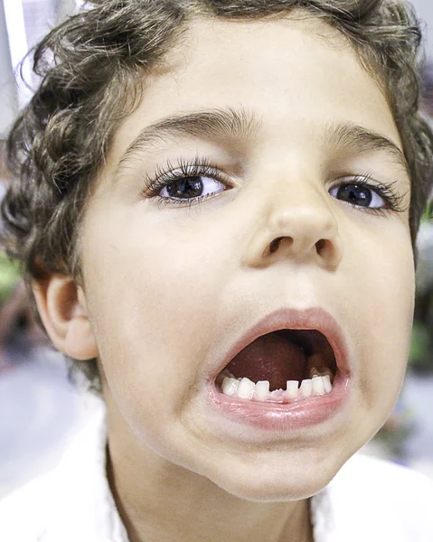 Child Missing Tooth — Stock Photo, Image