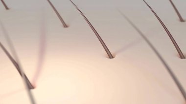 Sivilceler, Gelişim Aşamaları, Grafik Canlandırması