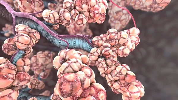 Pulmoner alveolus, çoğul pulmoner alveoller, akciğerlerde karbondioksitin kan ve oksijen indiği küçük hava alanlarından herhangi biri.
