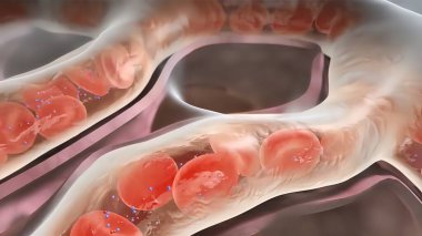Pulmoner dolaşım amfizeminin 3 boyutlu tıbbi çizimi