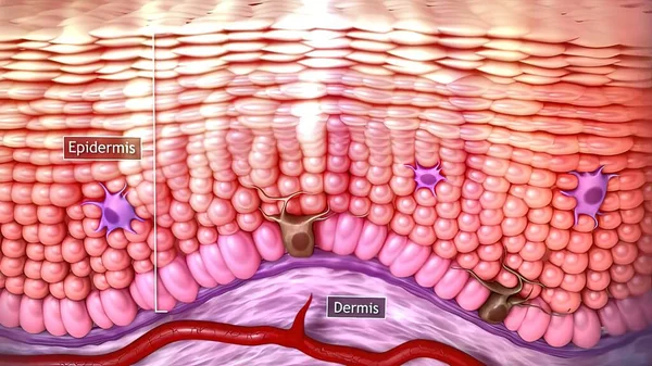 Cilt kanserinin 3 boyutlu tıbbi örnekleri: Squamous hücre kanseri, bazal hücre kanseri