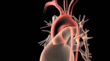 Hipoplastik sol kalp sendromu, kalbin sol tarafında ciddi derecede az gelişim gösteren nadir bir konjenital kalp bozukluğudur. Sol ventrikül, aort, aort kapakçığı veya mitral kapakçığı etkileyebilir. 3B Hazırlama
