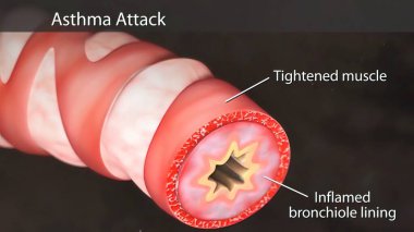 Manken ağıyla bronşlu insan ciğerleri. Döngü hareketi canlandırılmış 3 boyutlu canlandırma