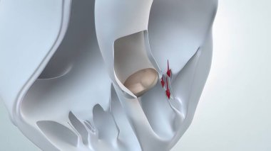 Aort kapakçığı, insan kalbinin sol ventrikül ve aort arasındaki kapakçığıdır. Bu kalp kapakçıklarından biri, diğeri ise akciğer kapakçığı. 3B Hazırlama