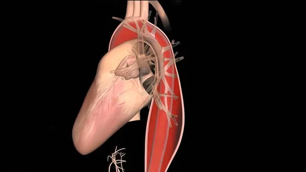 Sindrome Ipoplastica Del Cuore Sinistro Raro Difetto Cardiaco Congenito Cui — Foto Stock