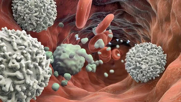 Макрофаг Пожирающий Раковые Клетки Иммунные Клетки Способные Физически Поглощать Поврежденные — стоковое фото