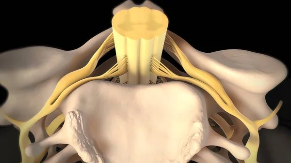 Spinal Disc Herniation Een Letsel Aan Demping Bindweefsel Tussen Wervels — Stockfoto