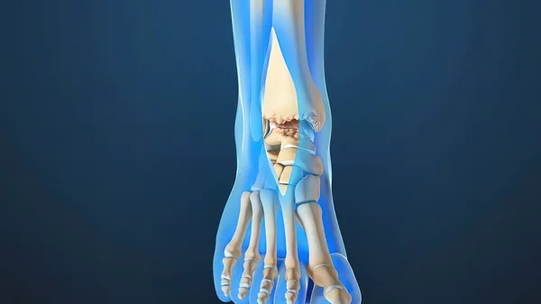 Renderizado Articulación Del Tobillo Anatomía Osteoartritis Tobillo Donde Los Huesos —  Fotos de Stock
