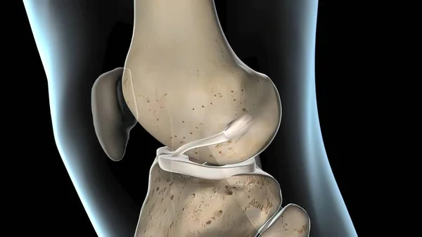 Ligamento Cruzado Anterior Articulação Joelho Render — Fotografia de Stock